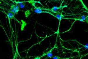 Exploding immune cells throwing out their DNA (green) upon activation