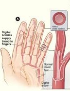 Scleroderma diagram